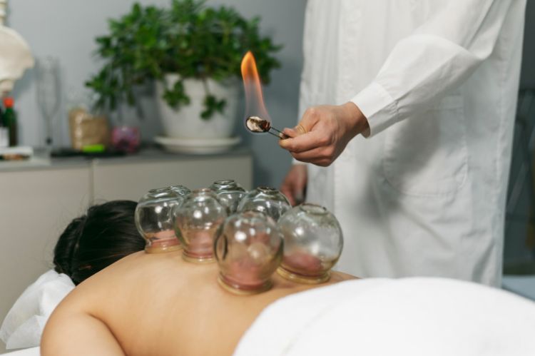 Cupping